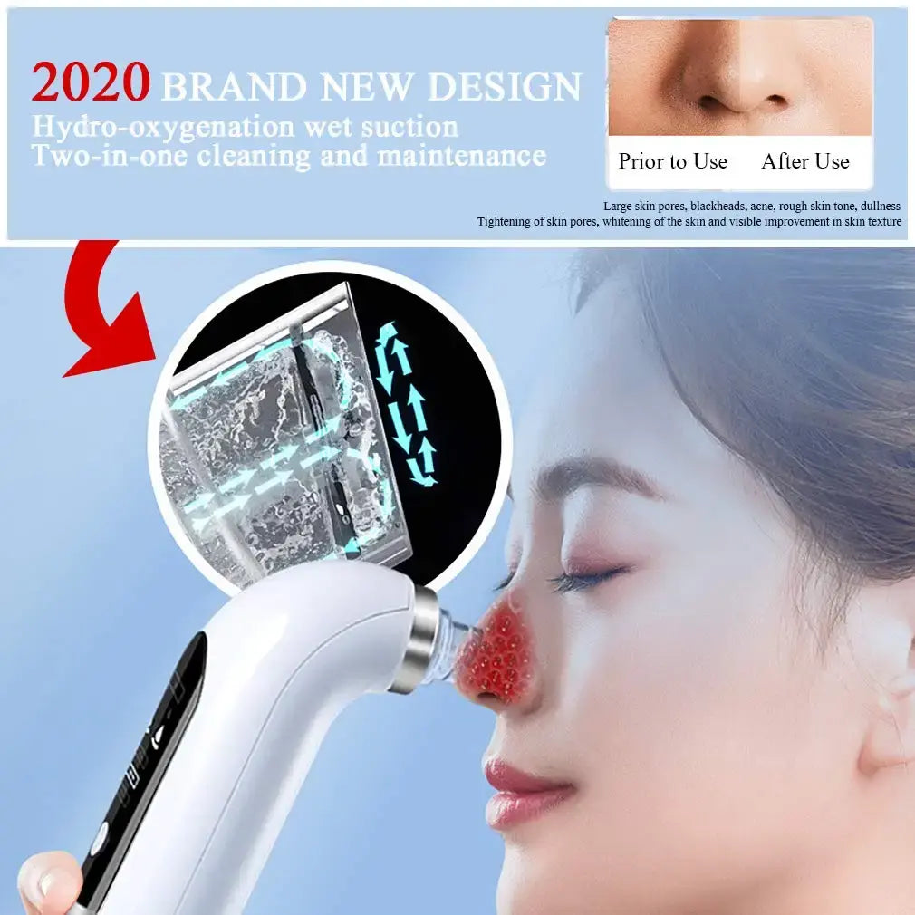 Blackhead Vacuum Suction Remover