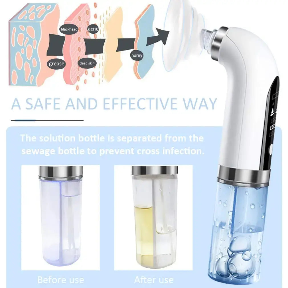 Blackhead Vacuum Suction Remover